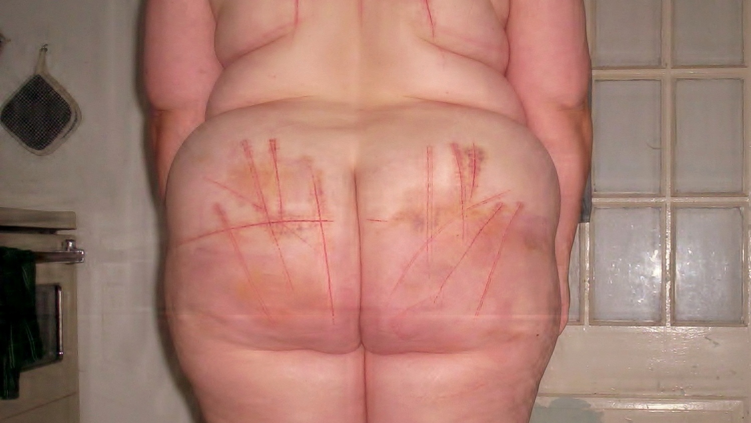 Cutting BBW Slave's Bleeding Ass and Bloody Tits — 19